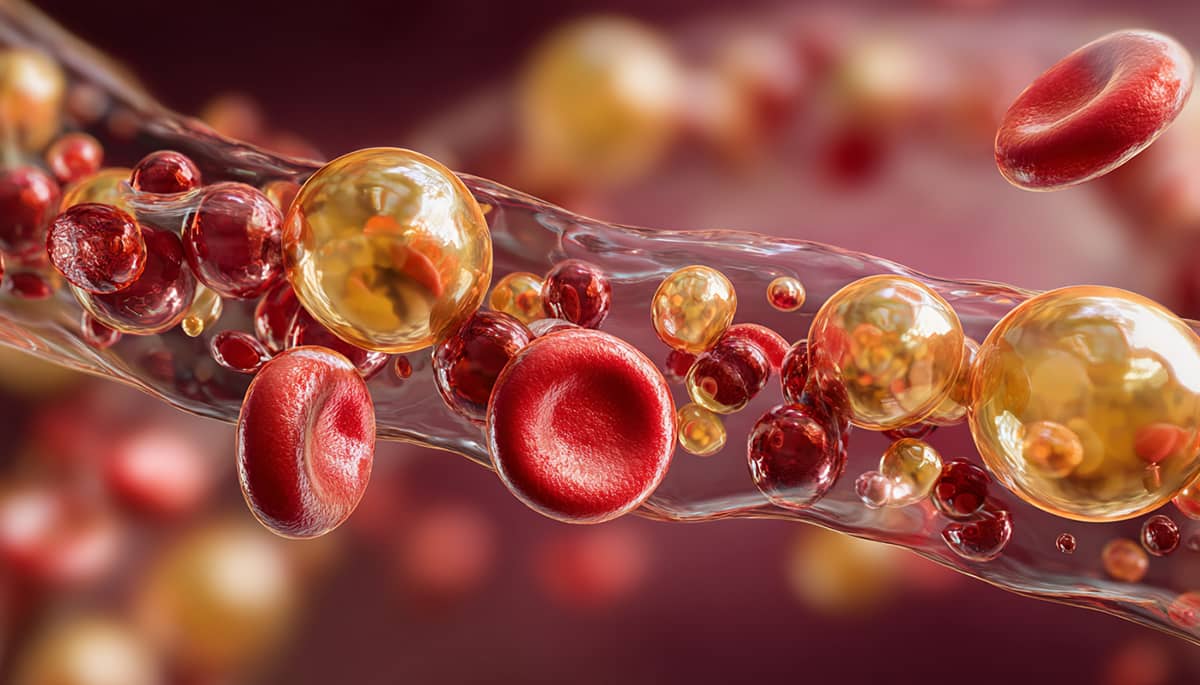 Lipid Panel
